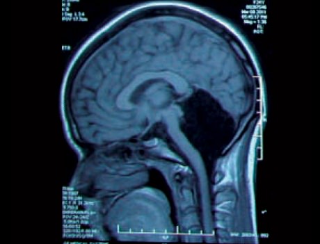Human head, MRI and 3D CT scans